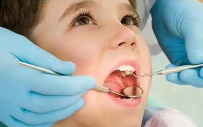 科普 | The Smile Institute为你解答儿童牙科常见问题