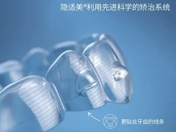 不用去医院，在家就能自助隐适美？这家公司开发了这个产品，然而……